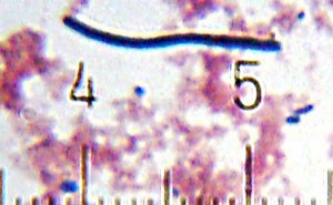 Lactobacillus